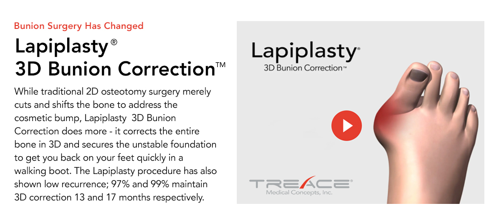 Lapiplasty 3D Bunion Correction at Family Footcare Connecticut